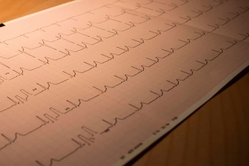 В сысертской больнице появился новый электрокардиограф